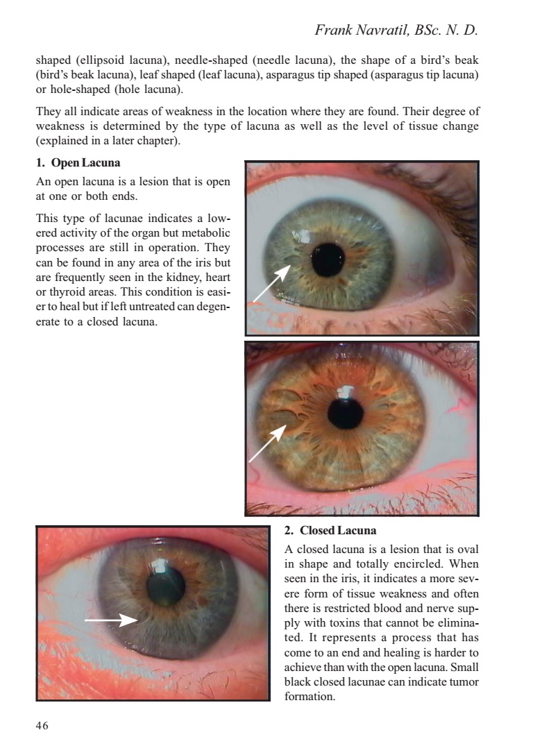 How To Read Iridology Eye Charts